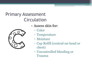 Primary Assessment	CirculationAssess skin for:ColorTemperatureMoistureCap Refill (central-on head or chest)Uncontrolled bleeding or Trauma