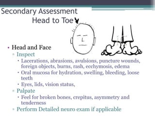 Secondary Assessment	Head to ToeHead and FaceInspect Lacerations, abrasions, avulsions, puncture wounds, foreign objects, burns, rash, ecchymosis, edemaOral mucosa for hydration, swelling, bleeding, loose teethEyes, lids, vision status, PalpateFeel for broken bones, crepitus, asymmetry and tendernessPerform Detailed neuro exam if applicable
