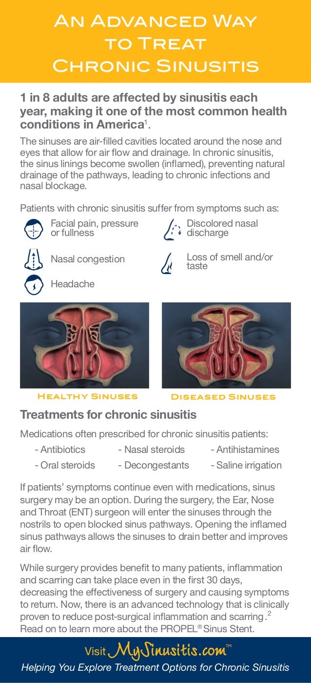An Advanced Way To Treat Chronic Sinusitis An Advanced Way To Treat Chronic Sinusitis