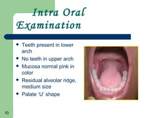 10
Intra Oral
Examination
Teeth present in lower
arch
No teeth in upper arch
Mucosa normal pink in
color
Residual alveolar ridge,
medium size
Palate ‘U’ shape
