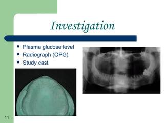 11
Investigation
Plasma glucose level
Radiograph (OPG)
Study cast
