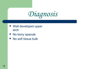 12
Diagnosis
Well developed upper
arch
No bony spacule
No soft tissue bulk
