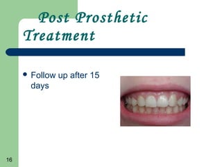 16
Post Prosthetic
Treatment
Follow up after 15
days