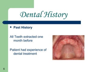 6
Dental History
Past History
All Teeth extracted one
month before
Patient had experience of
dental treatment