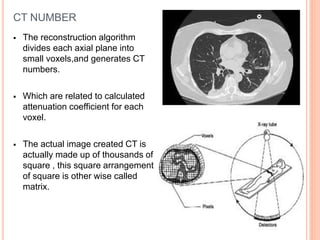 CT NUMBER
 The reconstruction algorithm
divides each axial plane into
small voxels,and generates CT
numbers.
 Which are related to calculated
attenuation coefficient for each
voxel.
 The actual image created CT is
actually made up of thousands of
square , this square arrangement
of square is other wise called
matrix.
 
