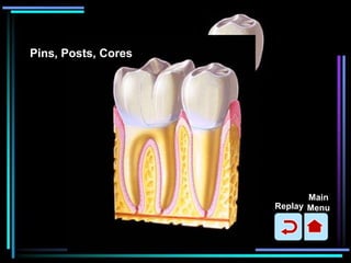 Dental Patient education Animations