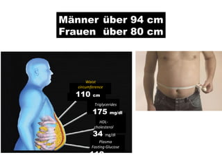Männer  über 94 cm Frauen  über 80 cm Waist circumference Triglycerides HDL- cholesterol Plasma Fasting Glucose 110  cm 175  mg/dl 34  mg/dl 112  mg/dl 