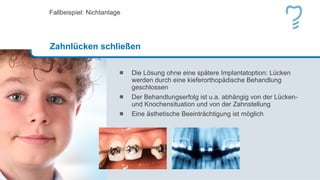 Die Lösung ohne eine spätere Implantatoption: Lücken werden durch eine kieferorthopädische Behandlung geschlossen Der Behandlungserfolg ist u.a. abhängig von der Lücken- und Knochensituation und von der Zahnstellung Eine ästhetische Beeinträchtigung ist möglich Fallbeispiel: Nichtanlage Zahnlücken schließen 