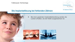 Bei einer geplanten Implantatbehandlung werden die Lücken erhalten, bis der Kiefer ausgewachsen ist.  Fallbeispiel: Nichtanlage Die Implantatlösung bei fehlenden Zähnen 