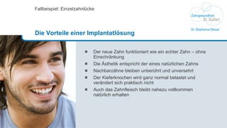 Der neue Zahn funktioniert wie ein echter Zahn – ohne Einschränkung Die Ästhetik entspricht der eines natürlichen Zahns Nachbarzähne bleiben unberührt und unversehrt Der Kieferknochen wird ganz normal belastet und verändert sich praktisch nicht Auch das Zahnfleisch bleibt nahezu vollkommen  natürlich erhalten Fallbeispiel: Einzelzahnlücke Die Vorteile einer Implantatlösung 