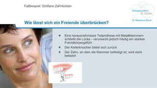 Eine herausnehmbare Teilprothese mit Metallklammern schließt die Lücke - verursacht jedoch häufig ein starkes Fremdkörpergefühl Der Kieferknochen bildet sich zurück Der Zahn, an dem die Klammer befestigt ist, wird stark belastet Fallbeispiel: Größere Zahnlücken Wie lässt sich ein Freiende überbrücken? 