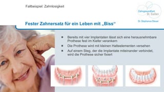 Bereits mit vier Implantaten lässt sich eine herausnehmbare Prothese fest im Kiefer verankern Die Prothese wird mit kleinen Halteelementen versehen Auf einem Steg, der die Implantate miteinander verbindet, wird die Prothese sicher fixiert Fallbeispiel: Zahnlosigkeit Fester Zahnersatz für ein Leben mit „Biss“ 