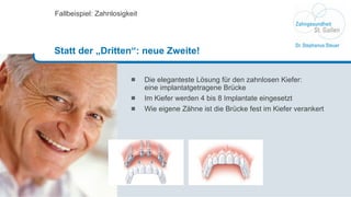 Die eleganteste Lösung für den zahnlosen Kiefer: eine implantatgetragene Brücke Im Kiefer werden 4 bis 8 Implantate eingesetzt Wie eigene Zähne ist die Brücke fest im Kiefer verankert Fallbeispiel: Zahnlosigkeit Statt der „Dritten“: neue Zweite! 