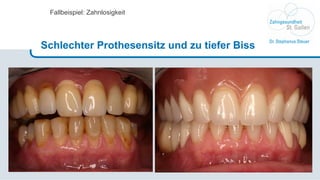 Fallbeispiel: Zahnlosigkeit Schlechter Prothesensitz und zu tiefer Biss 