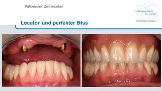 Fallbeispiel: Zahnlosigkeit Locator und perfekter Biss 