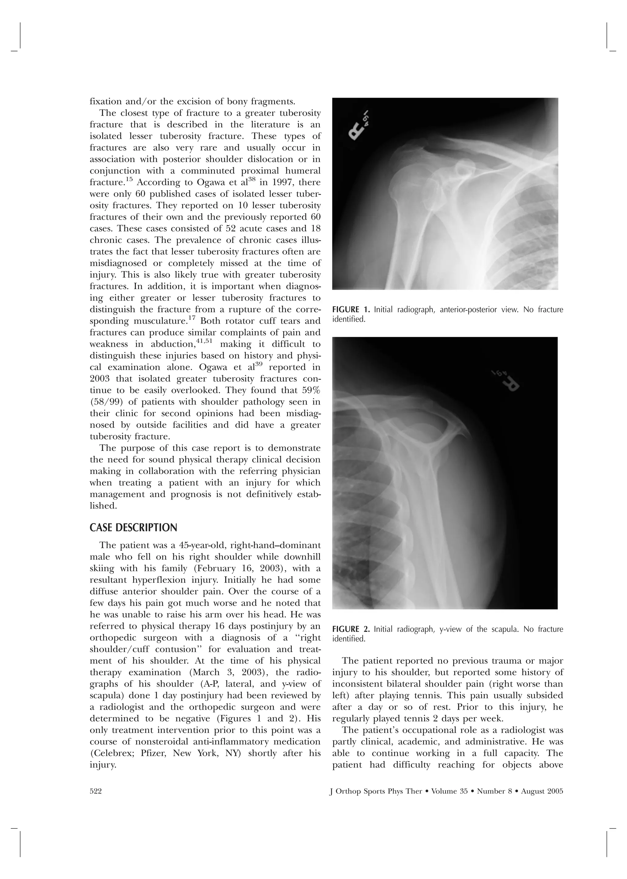 Patient Management with Greater Tuberosity Fracture and Rotator Cuff ...