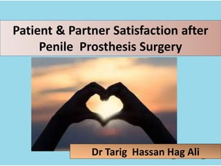 Patient & Partner Satisfaction after
Penile Prosthesis Surgery
Dr Tarig Hassan Hag Ali
 