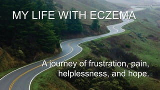 MY LIFE WITH ECZEMA
A journey of frustration, pain,
helplessness, and hope.
 