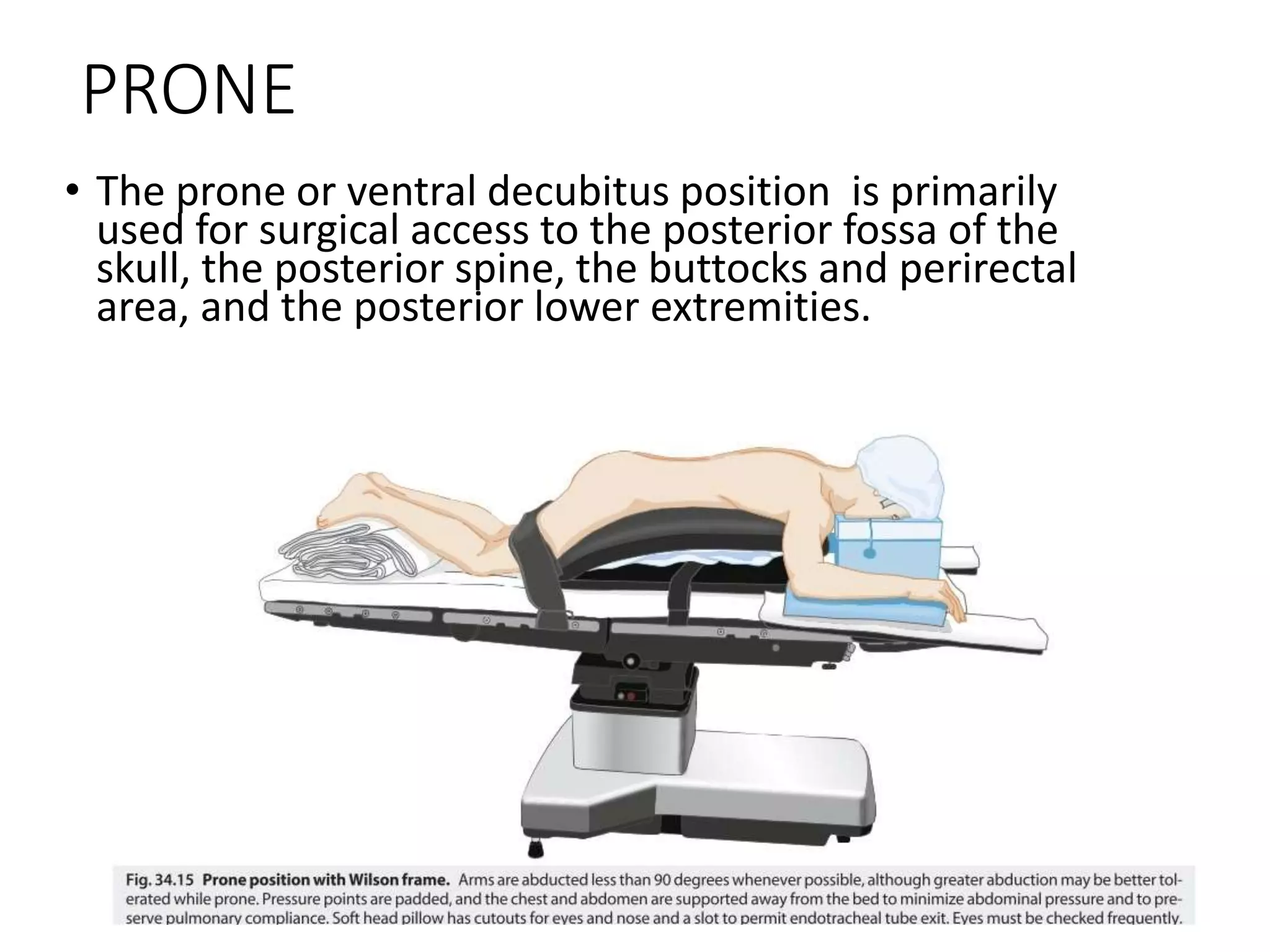 PRONE
• The prone or ventral decubitus position is primarily
used for surgical access to the posterior fossa of the
skull, the posterior spine, the buttocks and perirectal
area, and the posterior lower extremities.
 