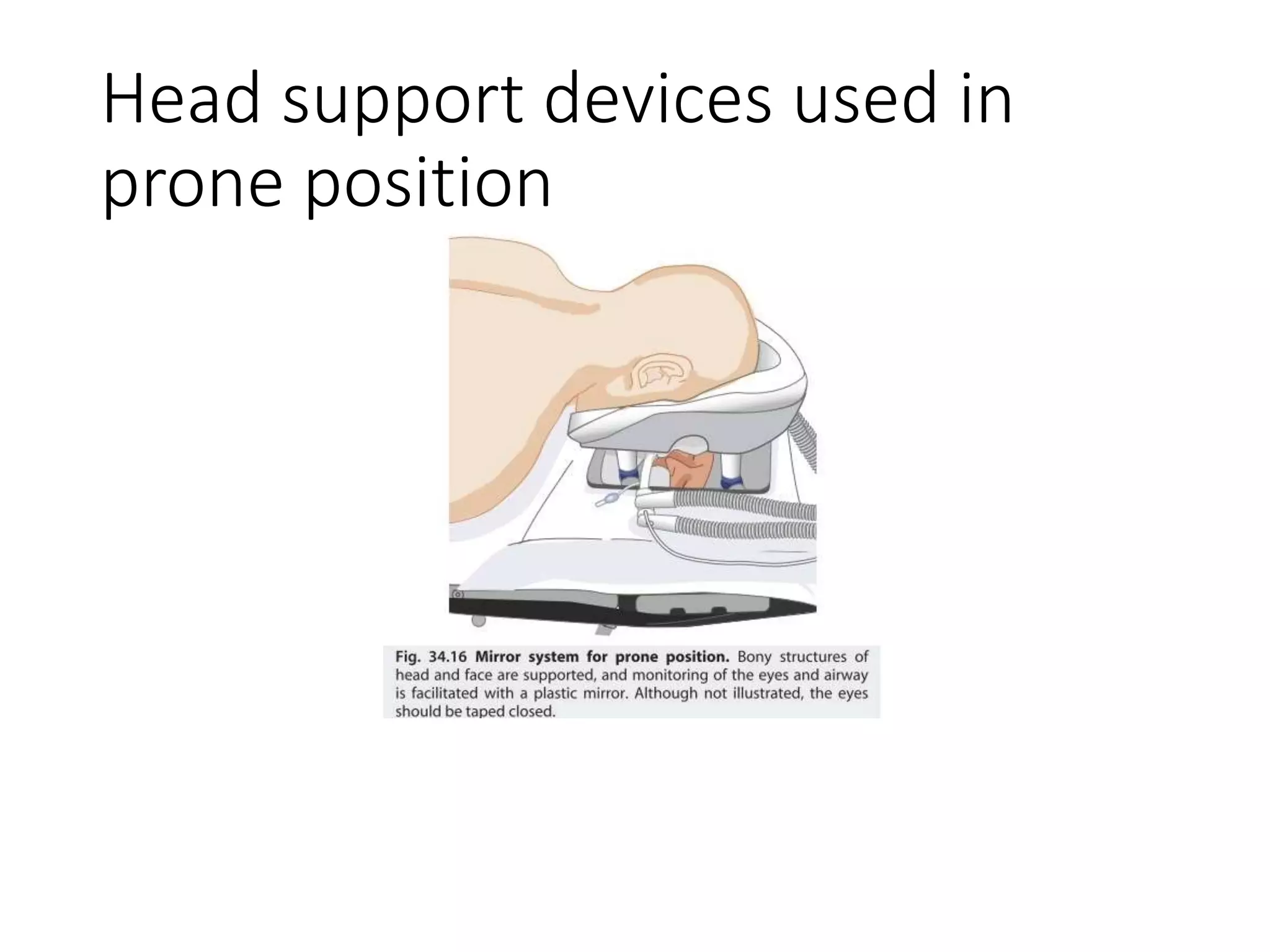 Head support devices used in
prone position
 