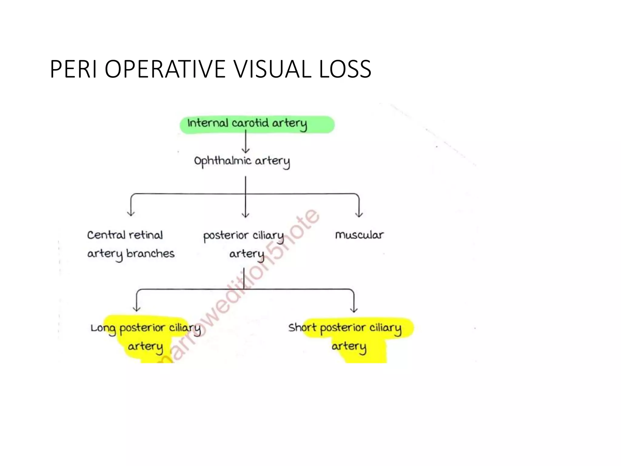 PERI OPERATIVE VISUAL LOSS
 