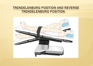 TRENDELENBURG POSITION AND REVERSE
TRENDELENBURG POSITION.
 