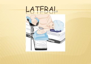 LATERAL
 