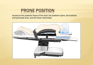 PRONE POSITION
Access to the posterior fossa of the skull, the posterior spine, the buttocks
and perirectal area, and the lower extremities
 