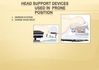 HEAD SUPPORT DEVICES
USED IN PRONE
POSITION
1. MIRROR SYSTEM
2. HORSE SHOE REST
 