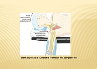 Brachial plexus is vulnerable to stretch and compression
 