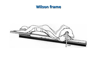 Patient Positioning.ppt in neurosurgery operations in theatre | PPT