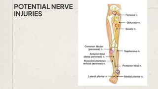 POTENTIAL NERVE
INJURIES
 