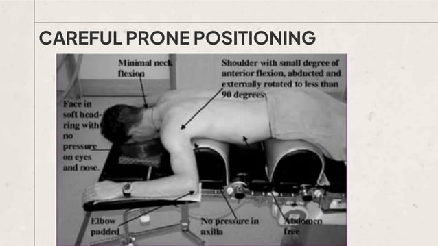 Anesthesia Ramp Position Patient Positioning - Anesthesia, position | PPTX | Death, Injury, or ...