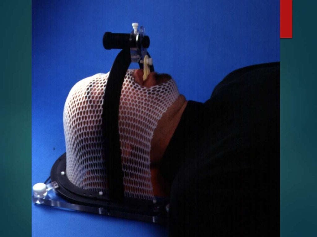 Patient Positioning and Immobilization Devices In Radiotherapy Planni…