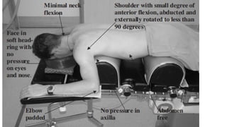Comprehensive Guide to Patient Positioning During Anesthesia for Safety ...