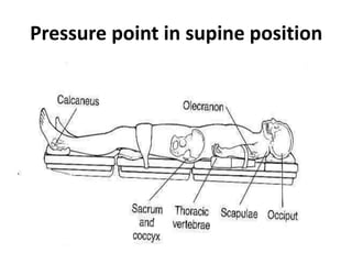 Pressure point in supine position
 