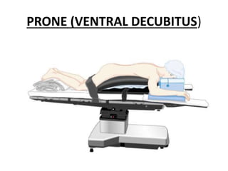 PRONE (VENTRAL DECUBITUS)
 