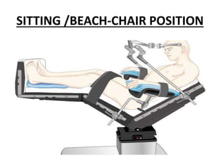 SITTING /BEACH-CHAIR POSITION
 