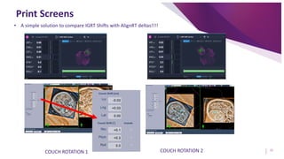 Patient Positioning for SRS Treatments Method to Compare SGRT Deltas vs ...
