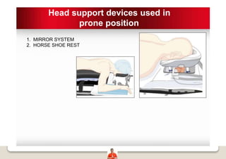 Head support devices used in
prone position
1. MIRROR SYSTEM
2. HORSE SHOE REST
 