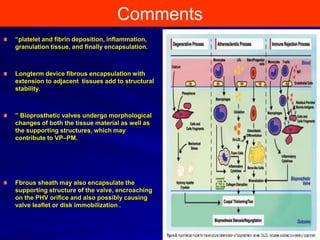 Patient prosthesis mismatch | PPTX