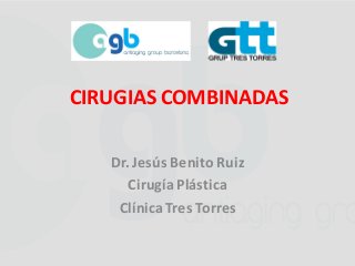 Dr. Jesús Benito Ruiz
Cirugía Plástica
ClínicaTres Torres
CIRUGIAS COMBINADAS
 