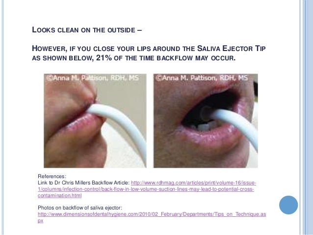 dentist suction tool