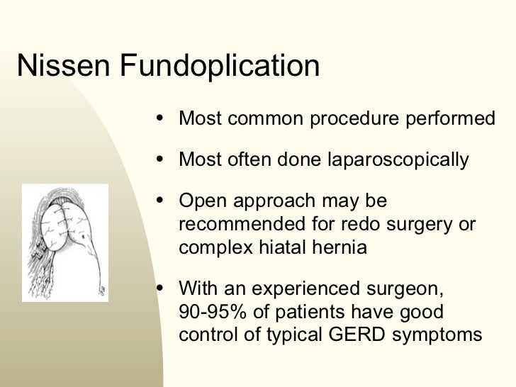 Surgical Options For GERD