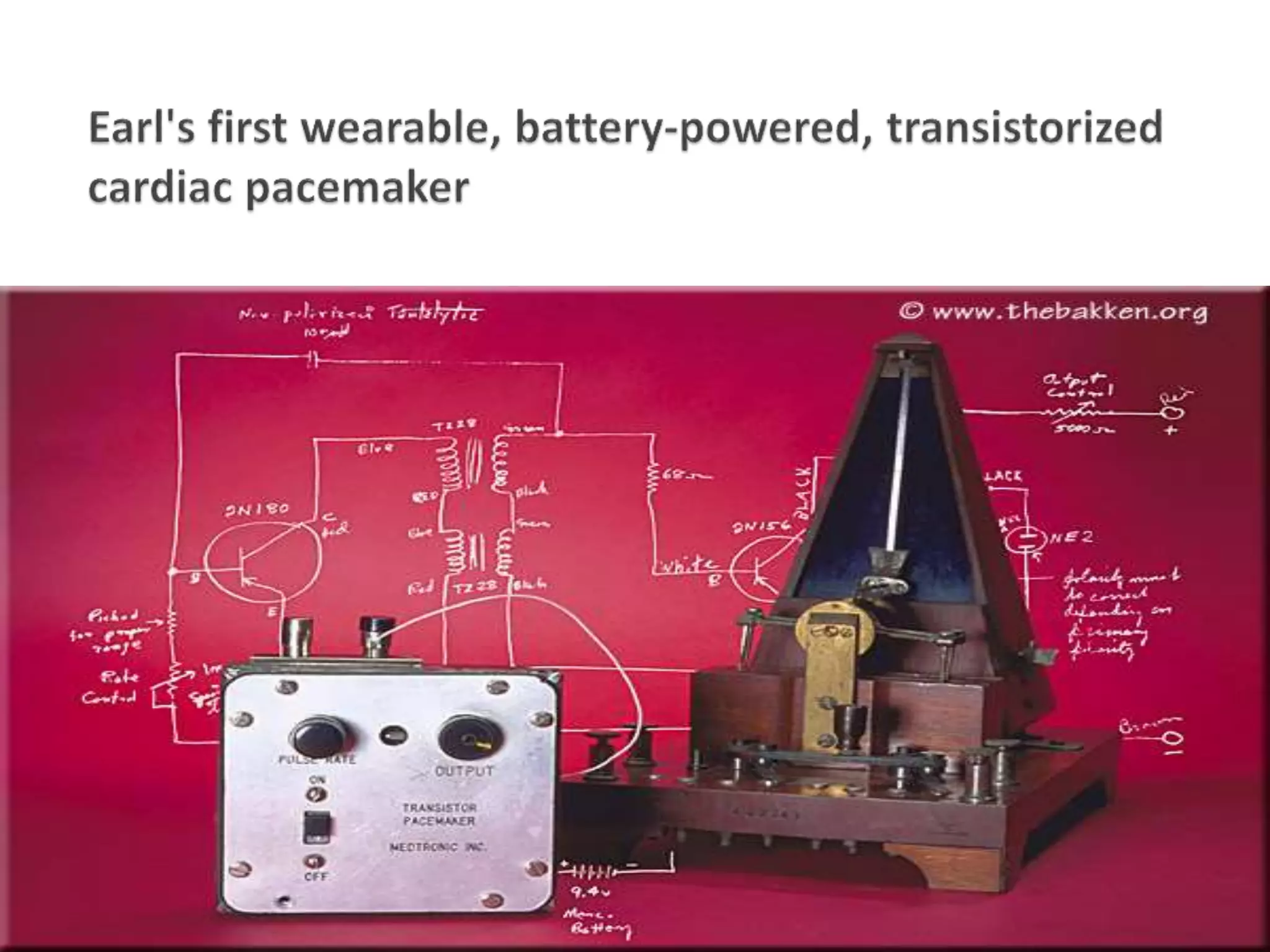 Patients with pacemaker anaesthetic implications | PPTX