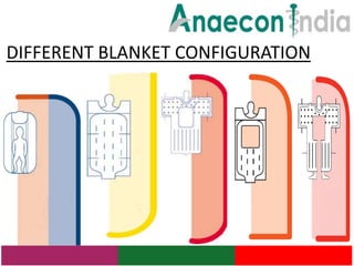DIFFERENT BLANKET CONFIGURATION
 