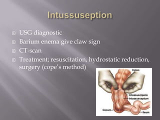  USG diagnostic
 Barium enema give claw sign
 CT-scan
 Treatment; resuscitation, hydrostatic reduction,
surgery (cope’s method)
 