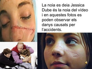 La noia es deia Jessica
Dube és la noia del vídeo
i en aquestes fotos es
poden observar els
danys causats per
l’accidents.
 