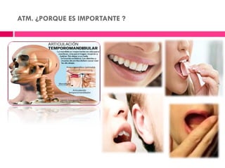 ATM. ¿PORQUE ES IMPORTANTE ?
 