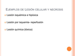 EJEMPLOS DE LESIÓN CELULAR Y NECROSIS


Lesión isquémica e hipóxica



Lesión por isquemia- reperfusión



Lesión química (tóxica)

 